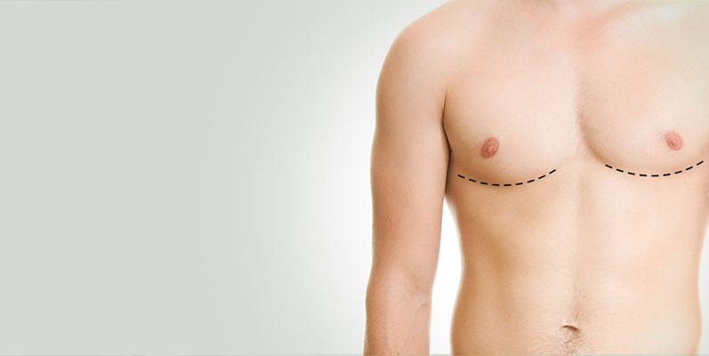 Male Chest Reduction Surgery