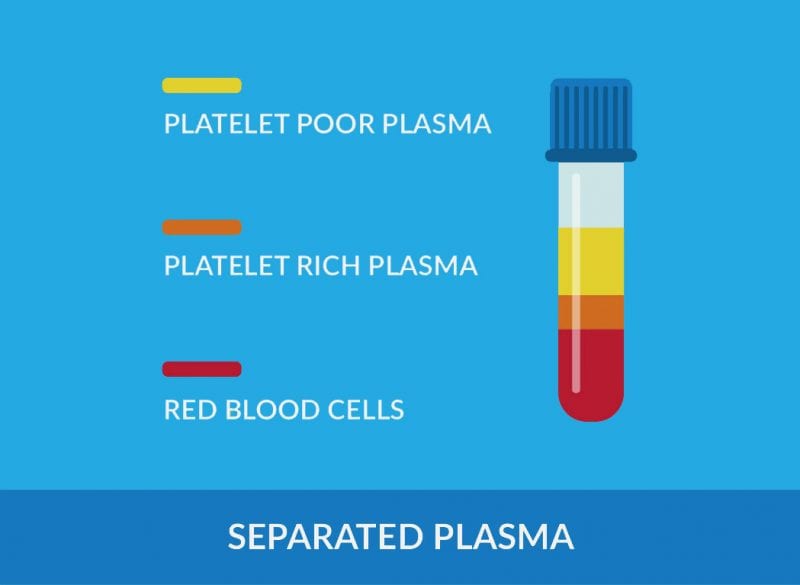 Graphic displaying the platelet rich plasma separated from the blood