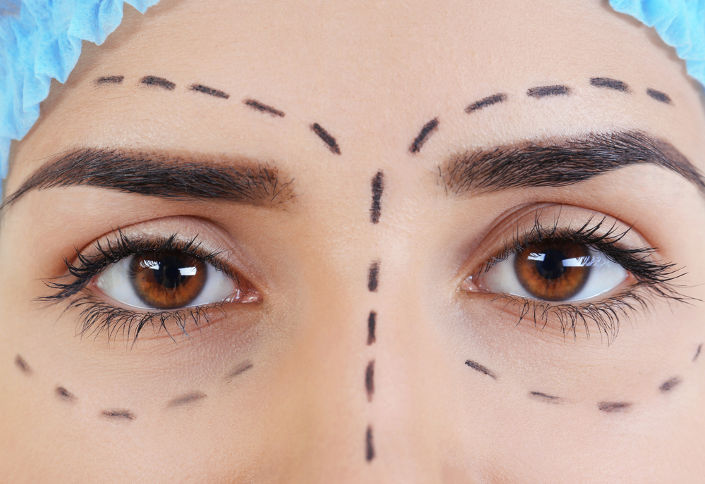 Both blepharoplasty and brow lift surgery are capable of providing anti-ageing results to the eyes