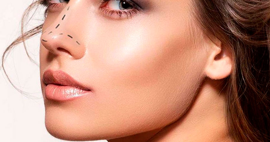 Undergoing a rhinoplasty surgery, or nose job, is a decision that can't be taken lightly