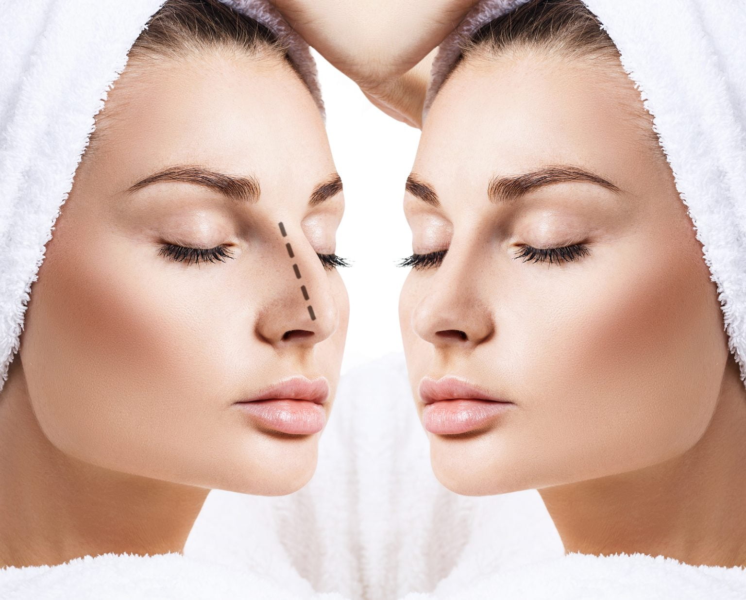 Nose job surgery is one of the most popular surgeries in the world